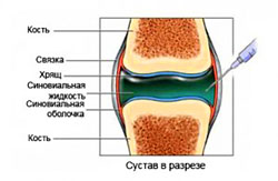 Гируан 2